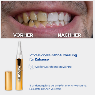 Teeth Whitening Gold Serum Pen® – Zahnaufhellungs Stift